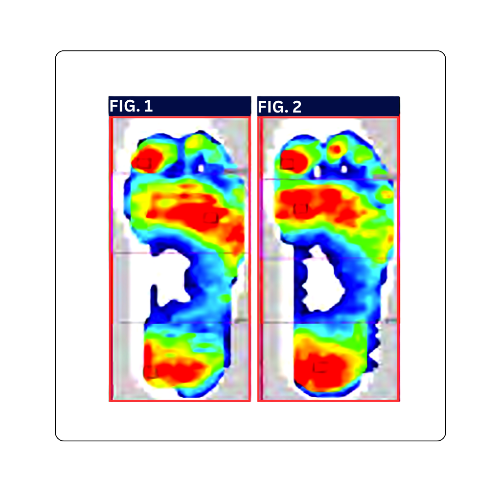 Color-coded footprints with red, blue, and green hues on a white background